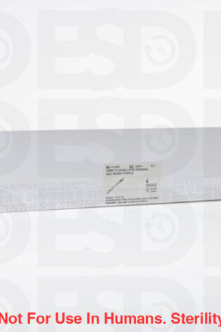 DEPUY SYNTHES: 474238S - EACH