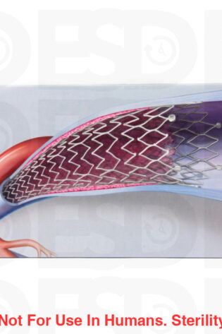 BARD VASCULAR: VENUL14060 - EACH