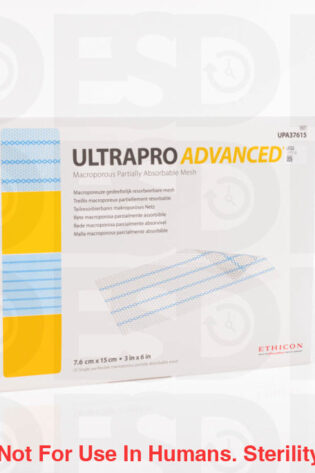 ETHICON: UPA37615 - BOX OF 3